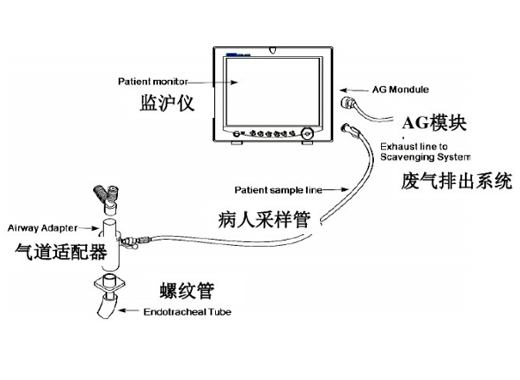先鋒科技探測器、光學元件為麻醉氣體濃度監測提供解決方案